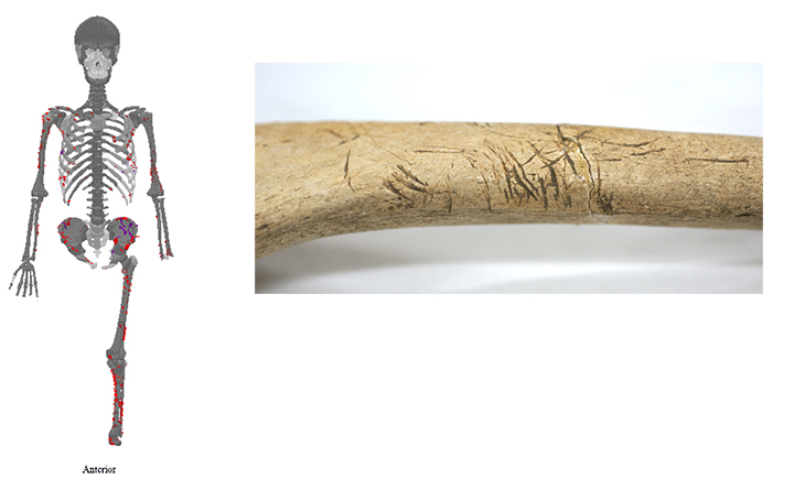 左の図は津雲24号人骨に残された咬痕の分布（腹側）を示しています（©Alyssa White）。丸の大きさは傷の深さを表しています。写真は左の上腕骨。特徴的な咬痕が観察されます（中務撮影）。