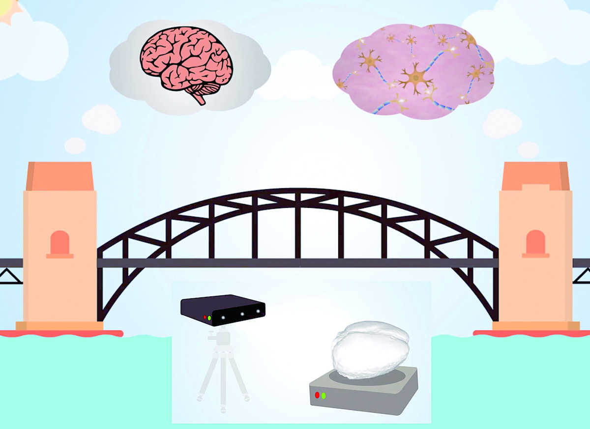 Bridging the scales of the brain