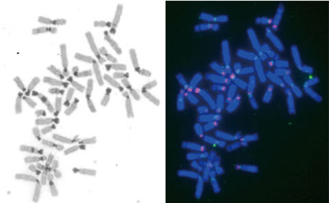 Why are Genomic “Garbage Cans” Important?