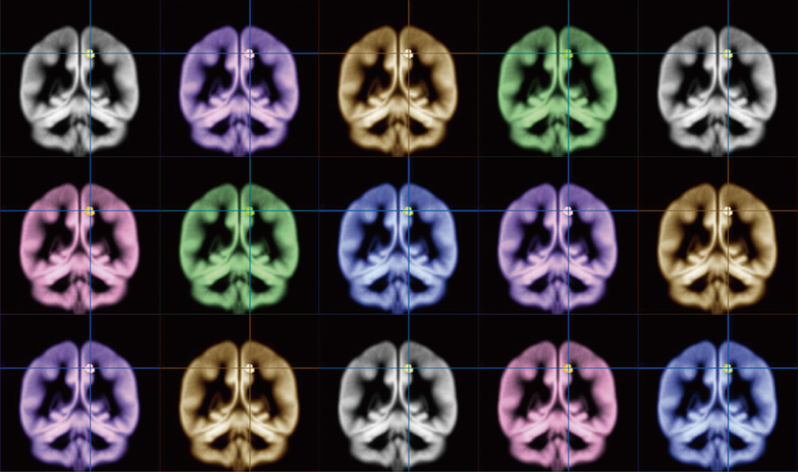 The search for happiness: using MRI to find where happiness happens