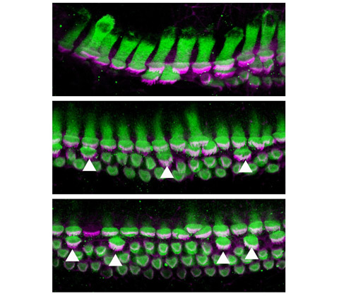 Temporal Regulation of Auditory Hair Cell Differentiation
