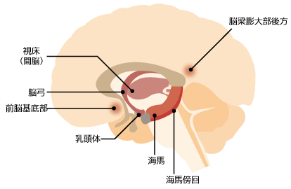 健忘症に関係する脳の部位