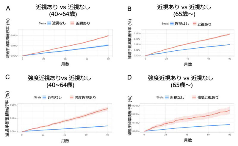 近視、強度近視では緑内障手術を要するリスクが最大約4倍に上昇～1400万人追跡調査で判明～