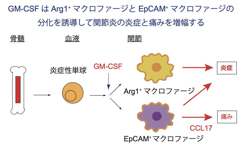 関節マクロファージの炎症惹起機構を解明―関節リウマチの新たな治療法開発に期待―
