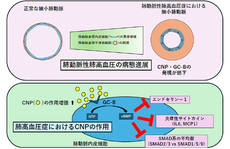 肺高血圧症の新規発症・進展メカニズムの解明―新規治療法の開発につながる可能性―