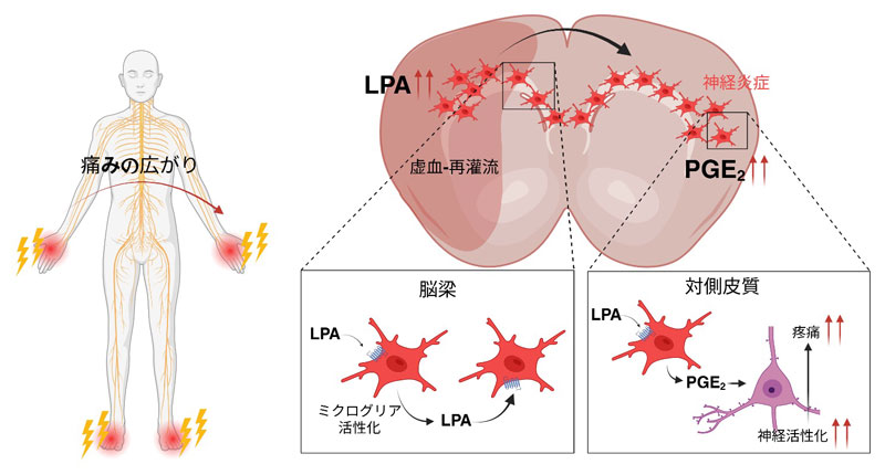 脳卒中後の痛みが両側へ広がる謎を画像で解明―LPAがミクログリアを脳梁内で連鎖的に活性化し、PGE₂増加を招く過程を可視化―