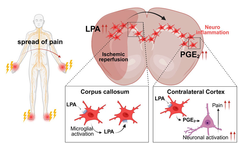 2606-main-neyama_pain-in-brain.jpg 