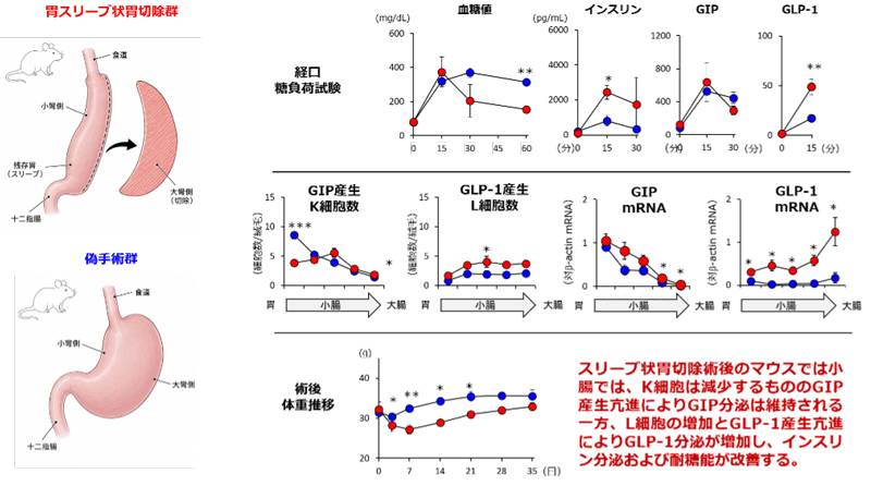 スリーブ状胃切除術が腸管形態とインクレチン産生細胞を変化させることを3次元解析で解明