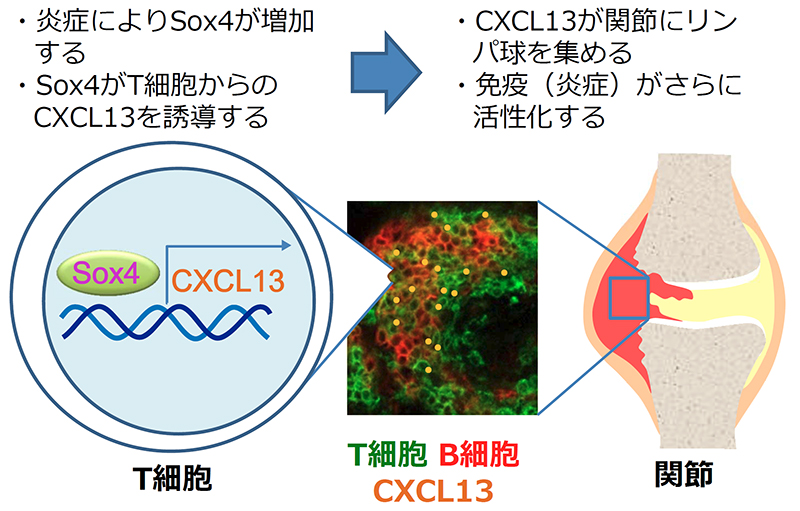 関節リウマチの病態に関わる転写因子を同定～炎症環境におけるT細胞の新たな機能解明に期待～