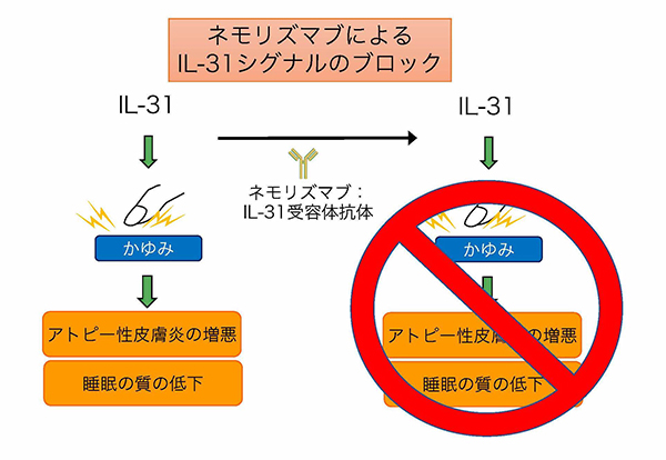 かゆみを標的にしたアトピー性皮膚炎の新規治療薬の有効性を確認 Il 31受容体の中和抗体によるアトピー性皮膚炎のかゆみと症状の緩和 京都大学
