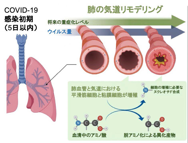 COVID-19が重症化する人は血液の代謝産物組成が異なる～感染初期での重症化リスクの予測マーカーを同定～
