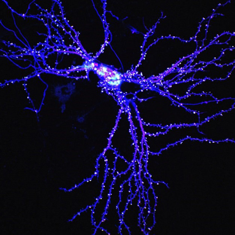 神経シナプス後部のタンパク質の集積を司る因子を発見
