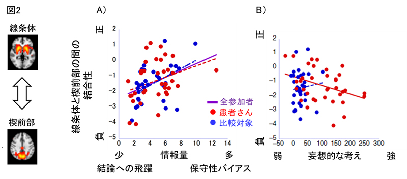 妄想の形成に関わる認知神経メカニズムを解明 ～妄想の新しい治療法の開発に期待～