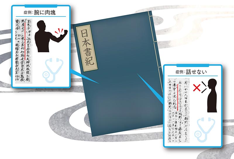 日本書紀は古代のカルテ?!～歴史書からひもとく古代日本の先天異常症例～