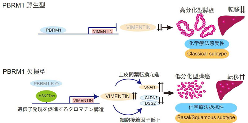 膵癌悪性化の分子機構解明～PBRM1はVimentin発現制御を介して膵癌の分化度、転移能を制御する～