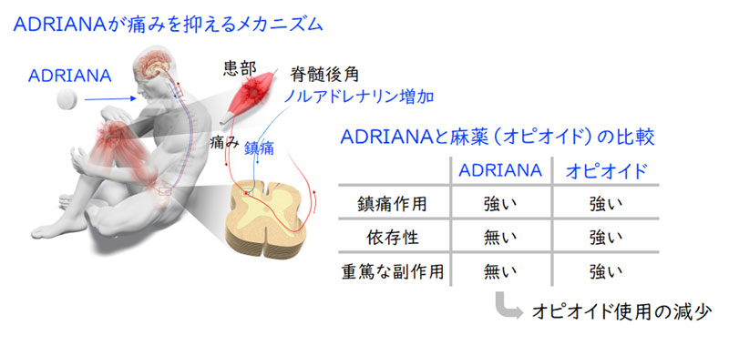 オピオイド危機から人々を救う画期的鎮痛薬～京大病院で医師主導臨床試験が実施された～