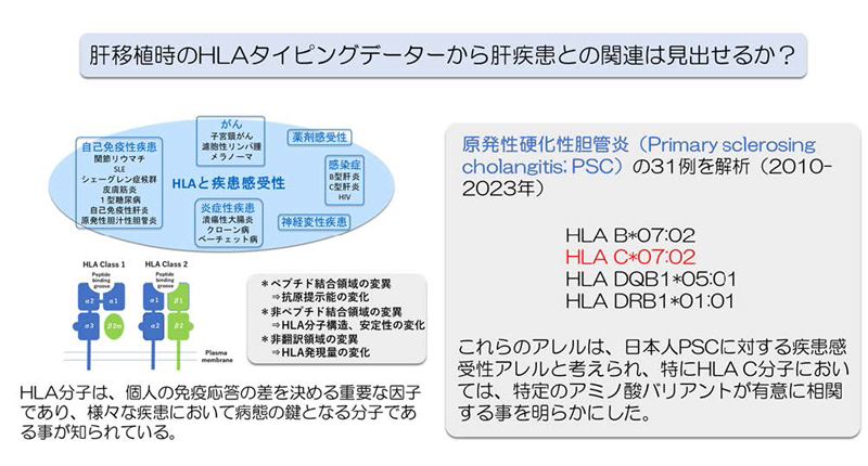 文章を入れてください
