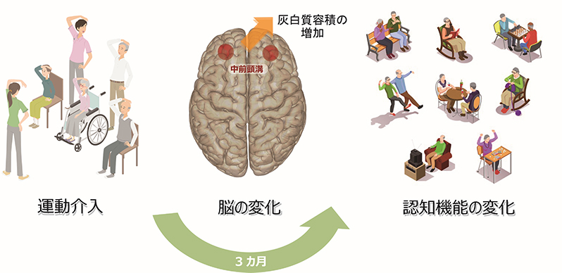 3か月間の運動介入により、前頭前野における皮質容積の増加と認知機能の向上が見られ、両者には相関が見られました。