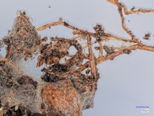 図：植物の根と共生する真菌類の菌糸