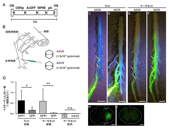 AAVベクターの神経内注入
