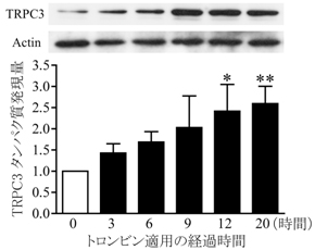 脳卒中の発症後におきる神経膠症のメカニズムを解明