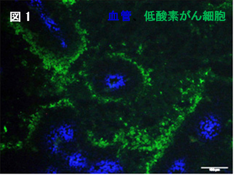 放射線治療後のがんの再発メカニズムの解明 | 京都大学