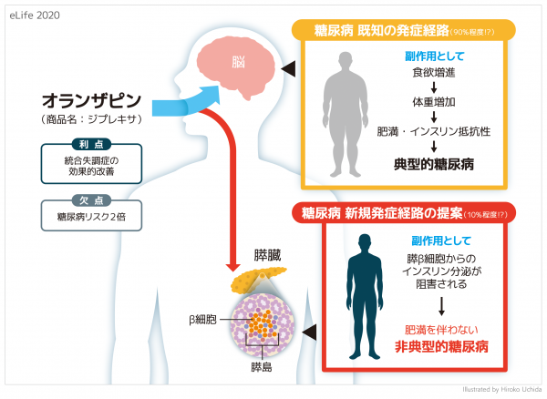 オランザピンの非典型的糖尿病誘発機構を解明 体重増加以外にも注意が必要 京都大学