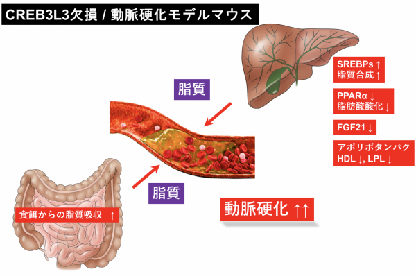 硬化 と は 動脈 動脈硬化症〔どうみゃくこうかしょう〕｜家庭の医学｜時事メディカル｜時事通信の医療ニュースサイト