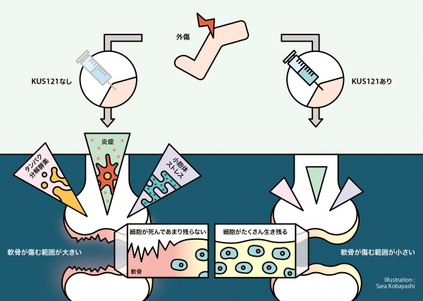京大開発の薬剤「KUS121」の変形性膝関節症への効果を確認