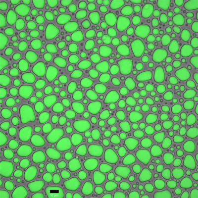 Artificial spider silk protein MaSp2 gathers in small clusters initially, but when potassium phosphate is added they begin to condense into large high density globules (Kyoto University/Numata Lab)