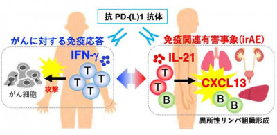 がん免疫療法の副反応による臓器傷害の原因解明に新たな一歩～がんに対する免疫応答と、有害事象に関わる免疫応答の違い～