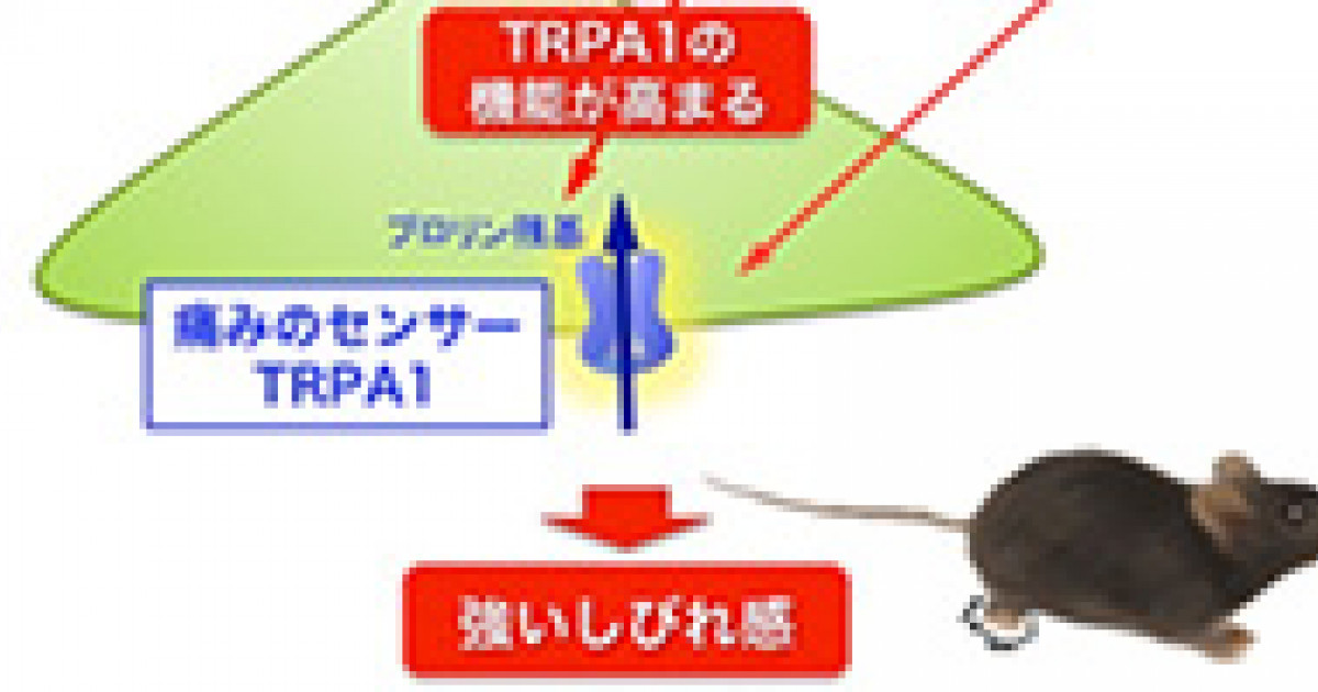 しびれ による痛みのメカニズムを解明 糖尿病や血流障害によるしびれ治療薬の開発に期待 京都大学 しびれ による痛みのメカニズムを解明 糖尿病や血流障害によるしびれ治療薬の開発に期待 京都大学