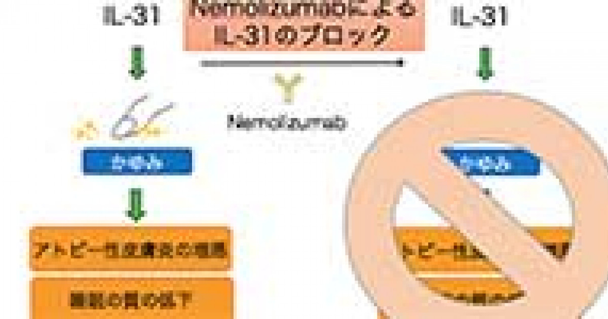 世界初 かゆみを標的にしたアトピー性皮膚炎の新たな治療戦略 京都大学