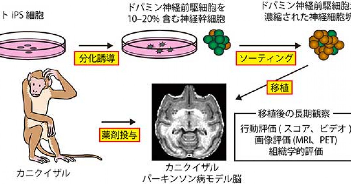 パーキンソン病霊長類モデルにおけるヒトips細胞由来ドパミン神経前駆細胞の移植の有効性と安全性の確認 京都大学