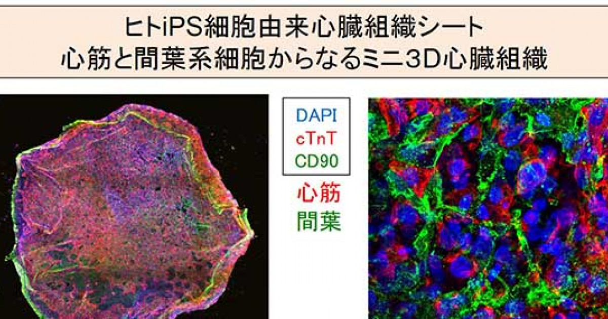 ヒトips細胞から3次元的な心臓組織を作製し 致死性不整脈の複雑な特徴を培養下に再現することに成功 京都大学 ヒトips細胞から3次元的な心臓組織を作製し 致死性不整脈の複雑な特徴を培養下に再現することに成功 京都大学