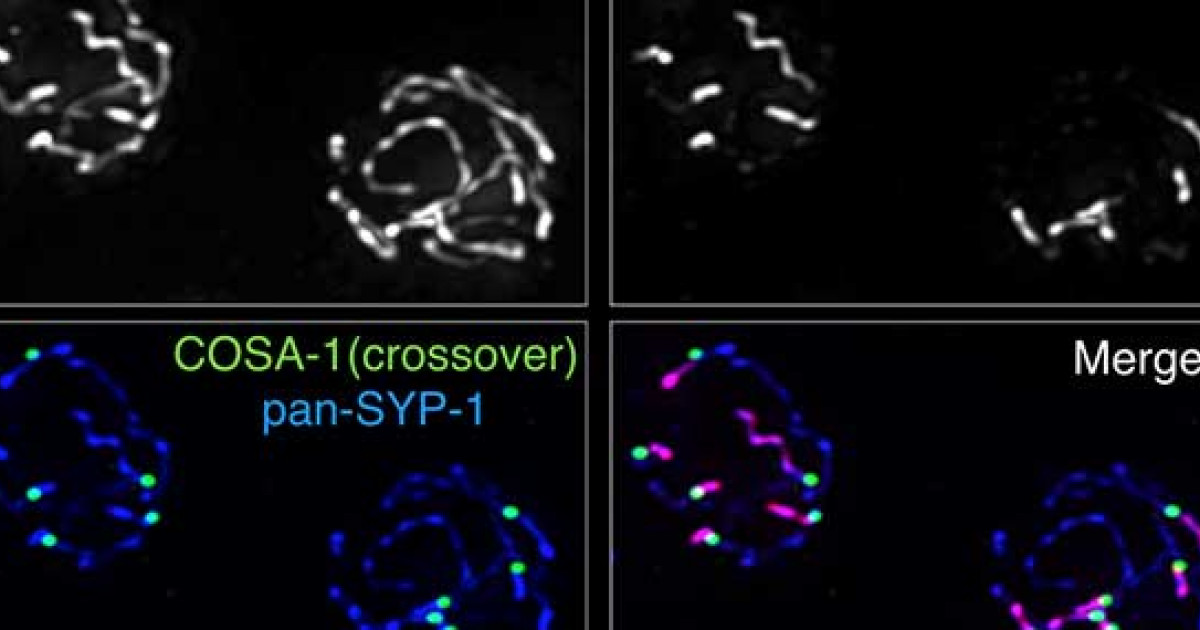 正常な卵子を生み出す細胞分裂に必須の分子メカニズムを解明 京都大学