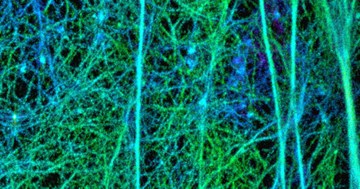 精子形態形成の分子メカニズムを超解像度顕微鏡と一分子