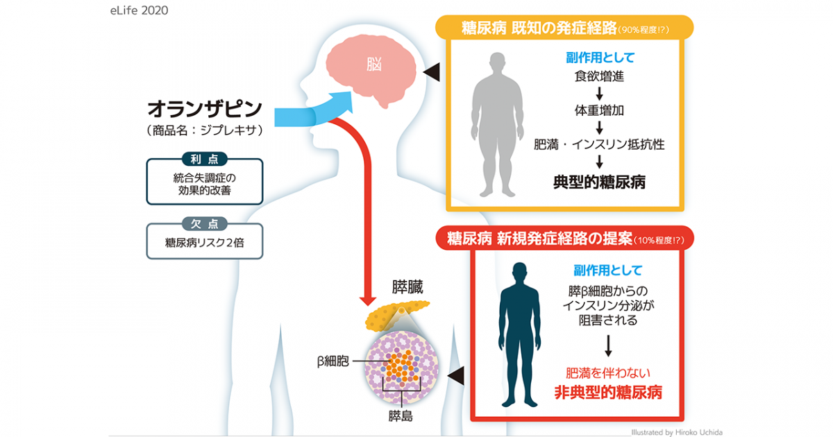 オランザピンの非典型的糖尿病誘発機構を解明 体重増加以外にも注意が必要 京都大学