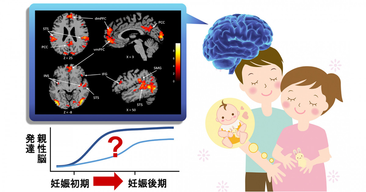 妊娠初期から発達する父親の 親性 脳の活動を確認 育児に対する父親の脳と心の発達には個人差がある 京都大学