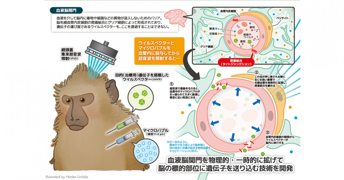 新時代の治療革命　脳活性療法 脳活性療法 DVD4枚セット 滝本裕之 手技DVD ✣ 滝本裕之の 脳活性