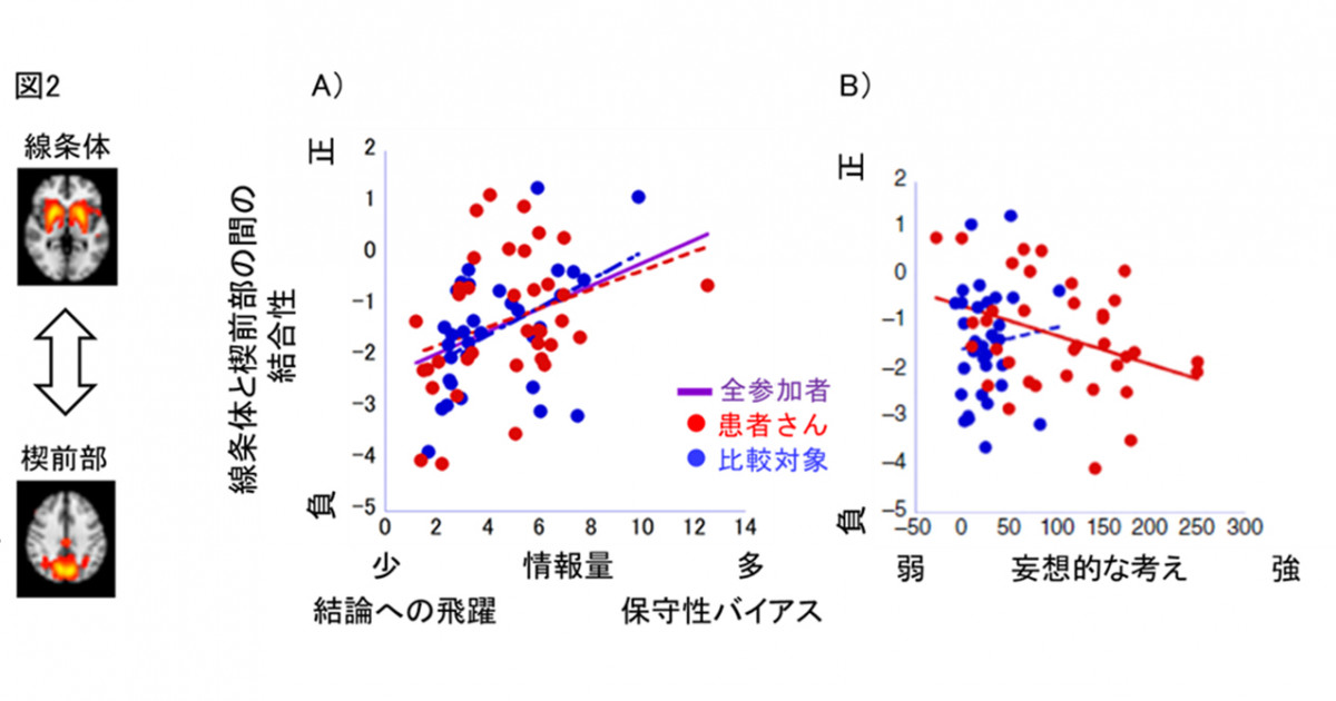 妄想の形成に関わる認知神経メカニズムを解明 ～妄想の新しい治療法の