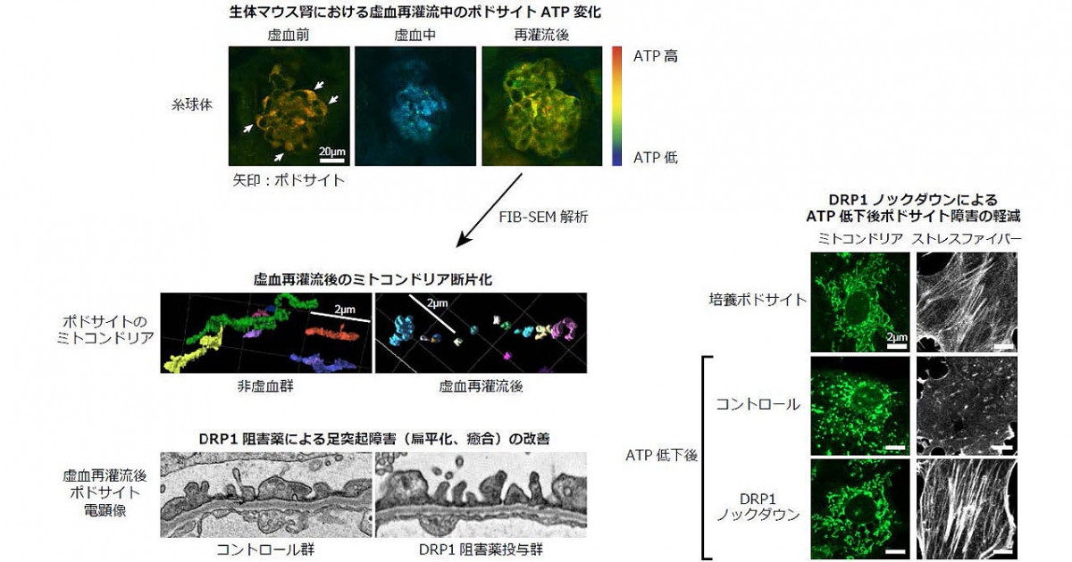 裁断済み　ミトコンドリア病 ミトコンドリア、若さの源 機能低下、病気の引き金に - 日本経済新聞
