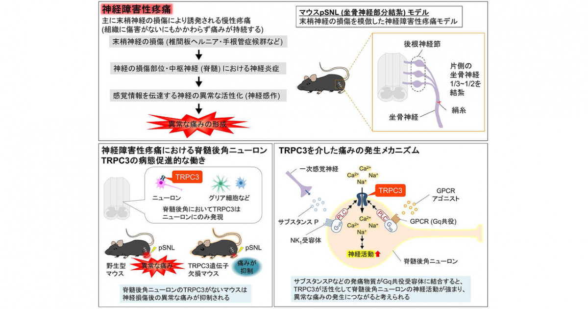 神経障害性疼痛の病態に関わる新たな分子機構の発見―脊髄後角