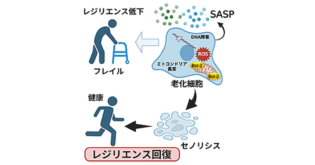 老化細胞除去の新規治療法開発に成功―加齢性疾患への実用化に期待