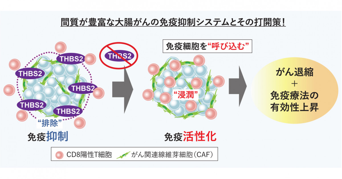 大腸がん：免疫細胞をがんに “呼び込む” 仕組みを解明―免疫治療が効か