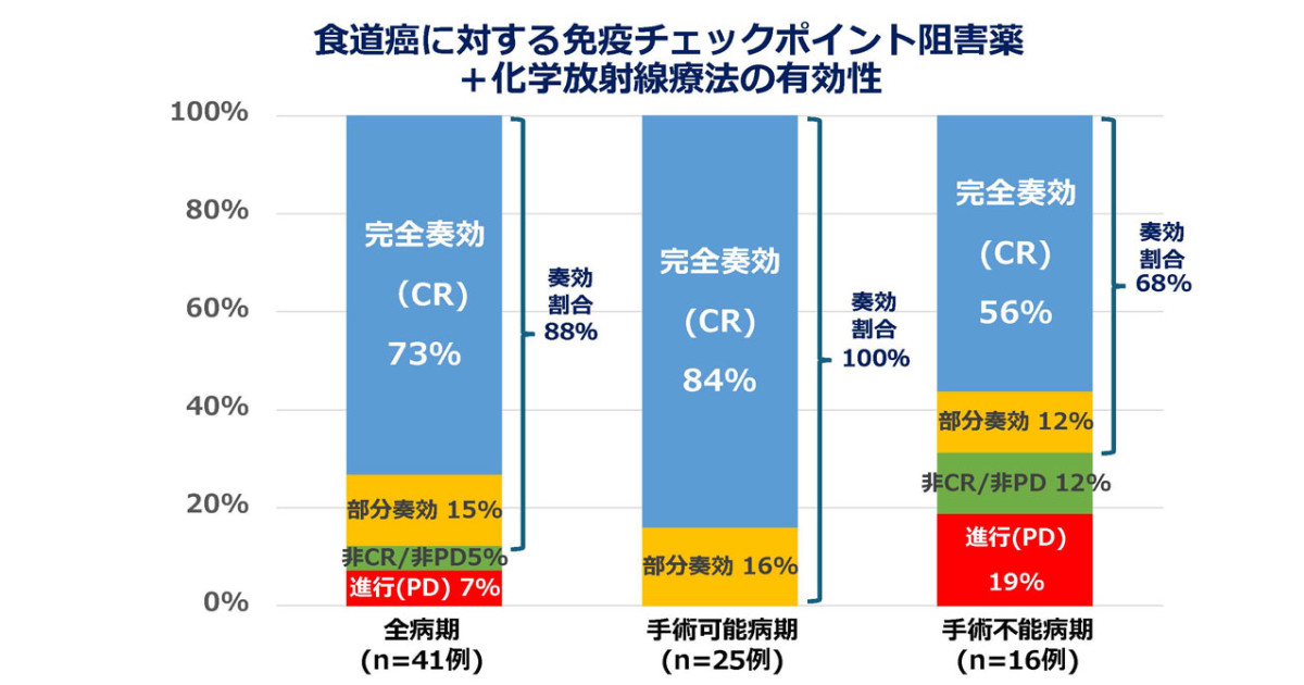 食道扁平上皮がんに対する根治的化学放射線療法と免疫チェックポイント