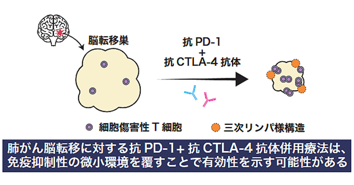 肺がん脳転移の「免疫の壁」を併用免疫療法が乗り越える可能性―脳転移の免疫抑制環境と免疫療法の作用を解明―