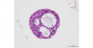 COVID-19 Research Using Bronchial Organoids and Drug Discovery Applications