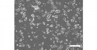 A novel method for generating naive human iPS cells with significantly higher differentiation potency