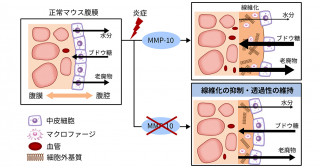 腹膜の炎症・線維化におけるMMP-10の役割を解明―腹膜透析の長期施行にむけた新たな治療ターゲットに―